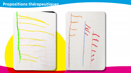 Graphomotricité – une étude de cas d’un patient en CE2