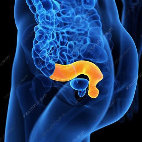 image de rectum